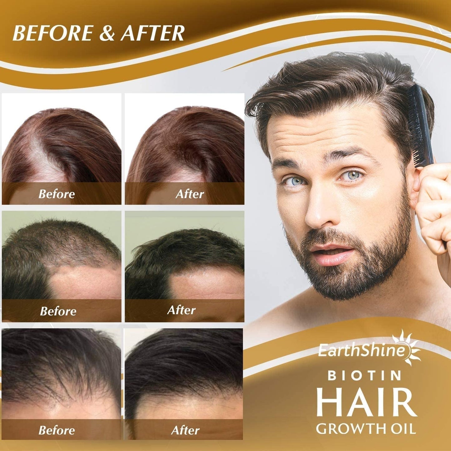 Biotin Serum: Hair Growth Oil for Thicker, Stronger Hair - Prevents Loss for Men & Women, 1.18 Oz (35 Ml)