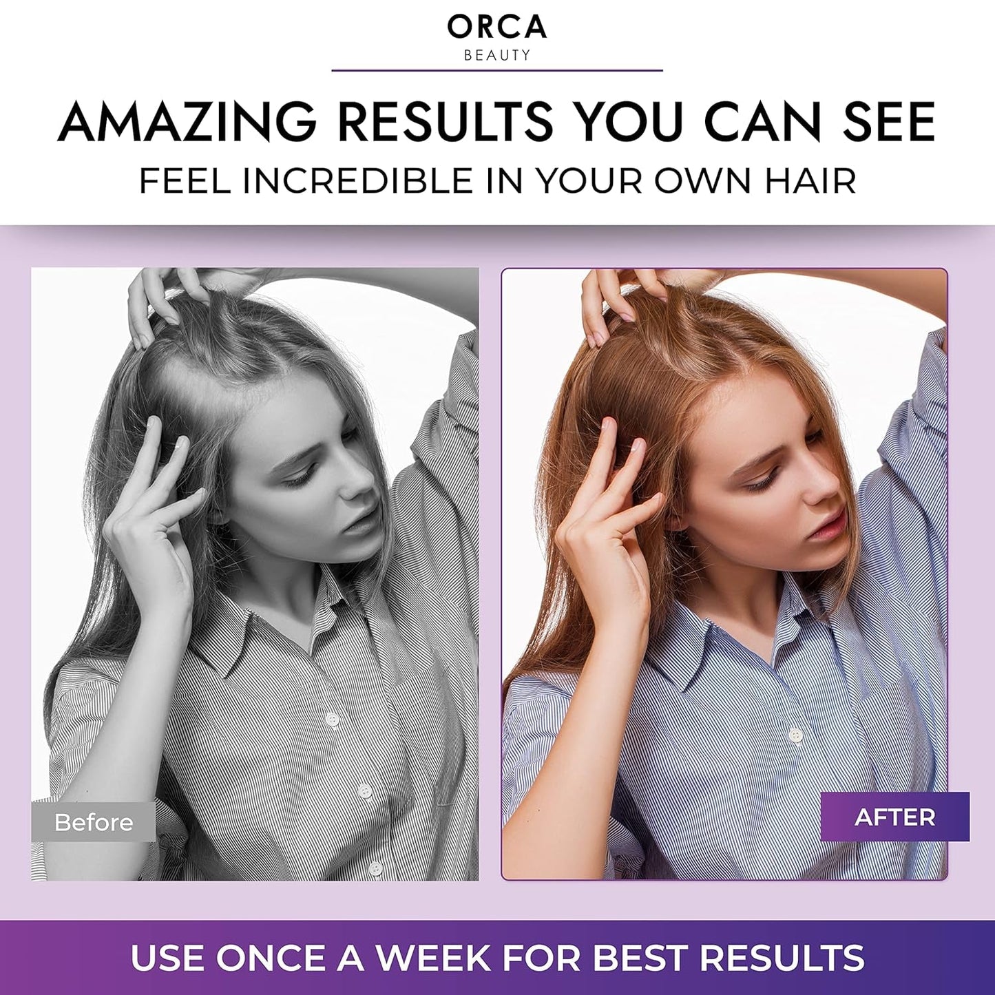 Biotin Shampoo and Conditioner for Women and Men - Volumizing Shampoo and Conditioner Set to Help Boost Thinning Hair - Hydrating, Nourishing Hair Loss Shampoo and Conditioner