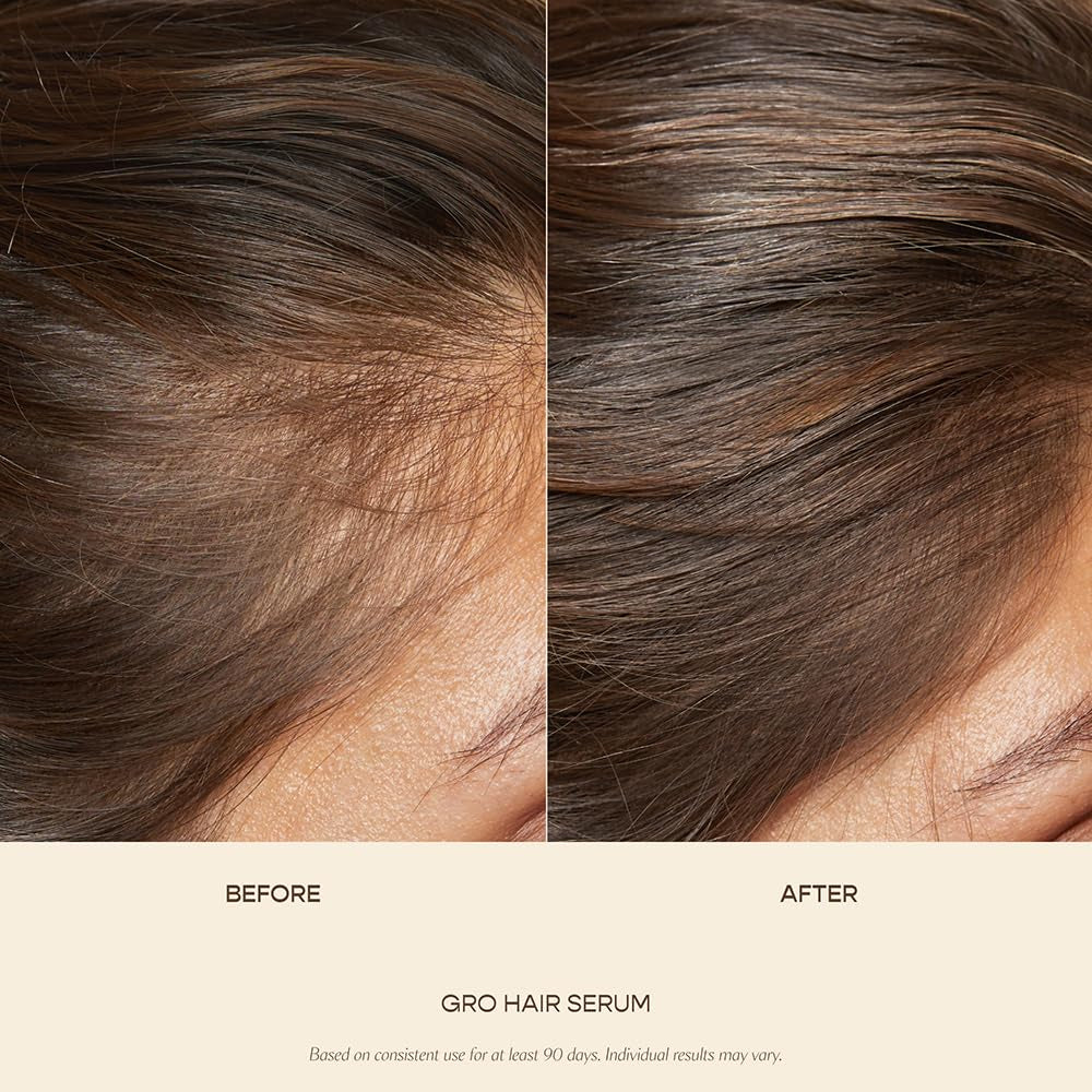 GRO Hair Serum for Hair Thinning & Shedding, Thicker Fuller Looking Hair in as Soon as 90 Days, Non Oily, Bergamot Scent, Vegan & Cruelty Free