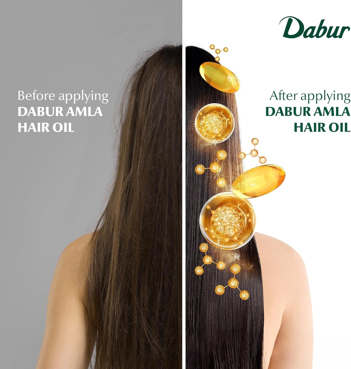Amla Hair Oil - Nourishing Indian Oil for Men & Women, for Healthy, Moisturized Hair and Scalp (300Ml)