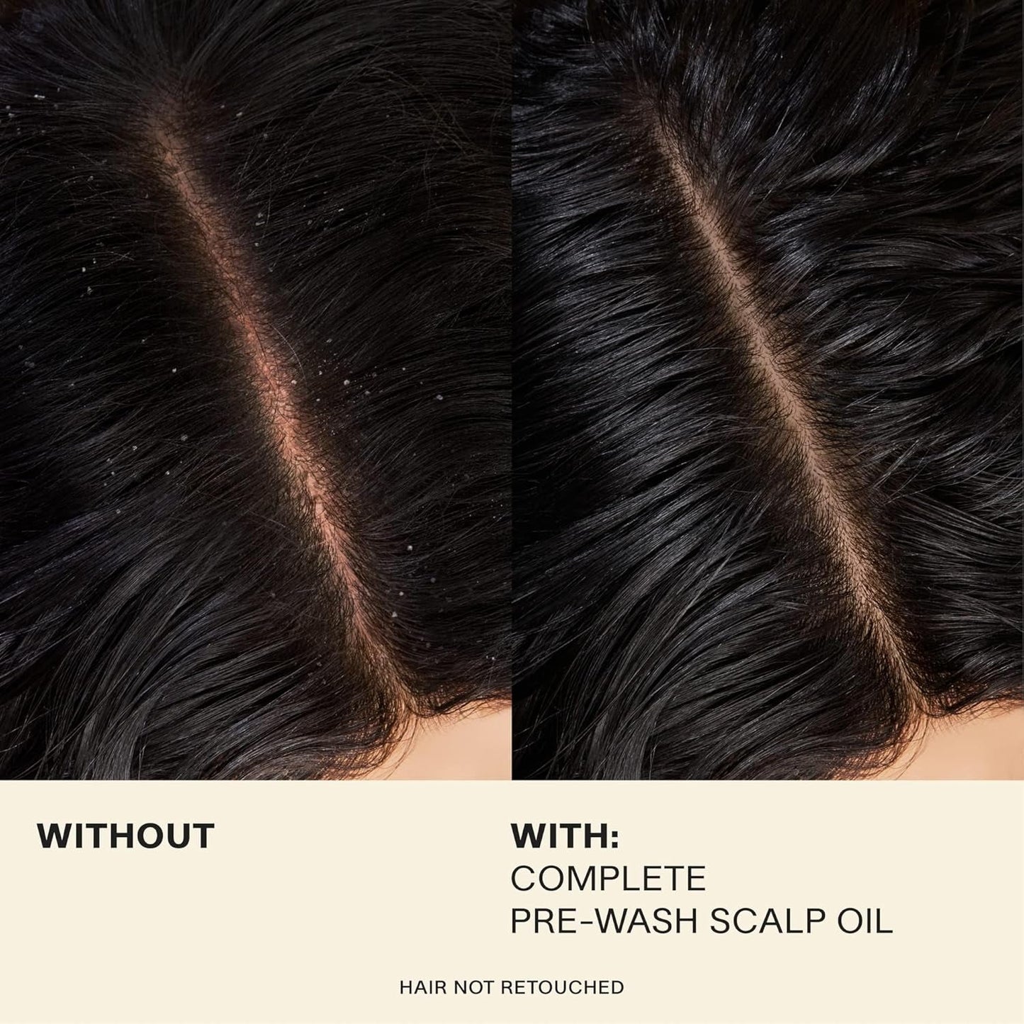 Complete Hair and Scalp Oil with Rosemary, Dry Scalp and Dry Hair Oil for All Hair Types, Silicone-Free, 1.7 Fluid Ounces
