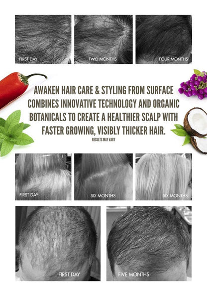 Hair Awaken Mousse: Color Safe, Volumizing, Firm Hold Hair Mousse to Thicken Hair, Sulfate-Free, Paraben-Free, 8.8 Oz
