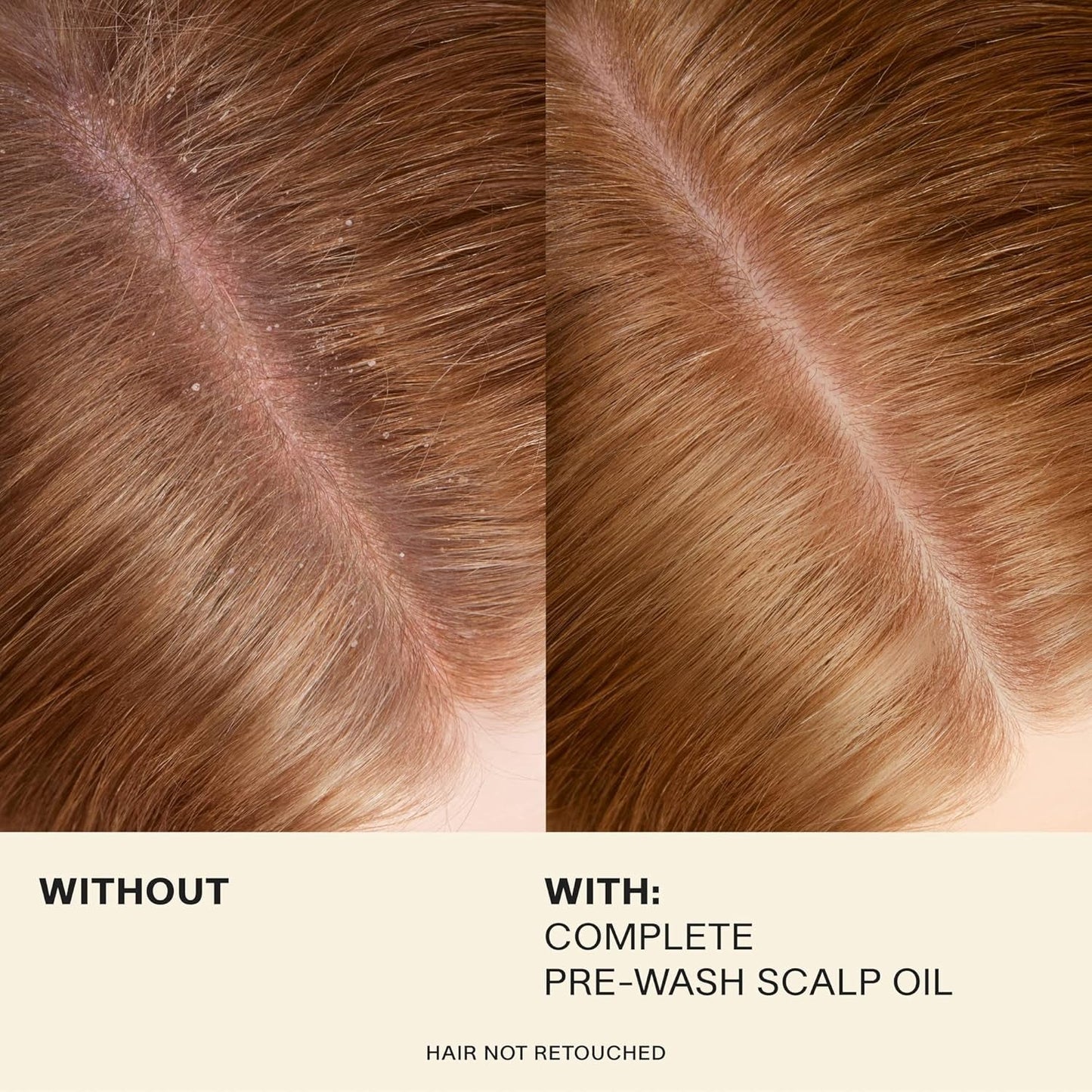 Complete Hair and Scalp Oil with Rosemary, Dry Scalp and Dry Hair Oil for All Hair Types, Silicone-Free, 1.7 Fluid Ounces