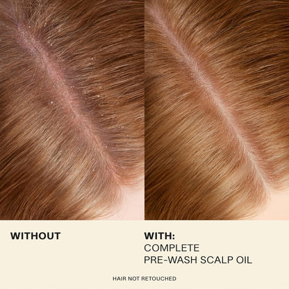 Complete Hair and Scalp Oil with Rosemary, Dry Scalp and Dry Hair Oil for All Hair Types, Silicone-Free, 1.7 Fluid Ounces