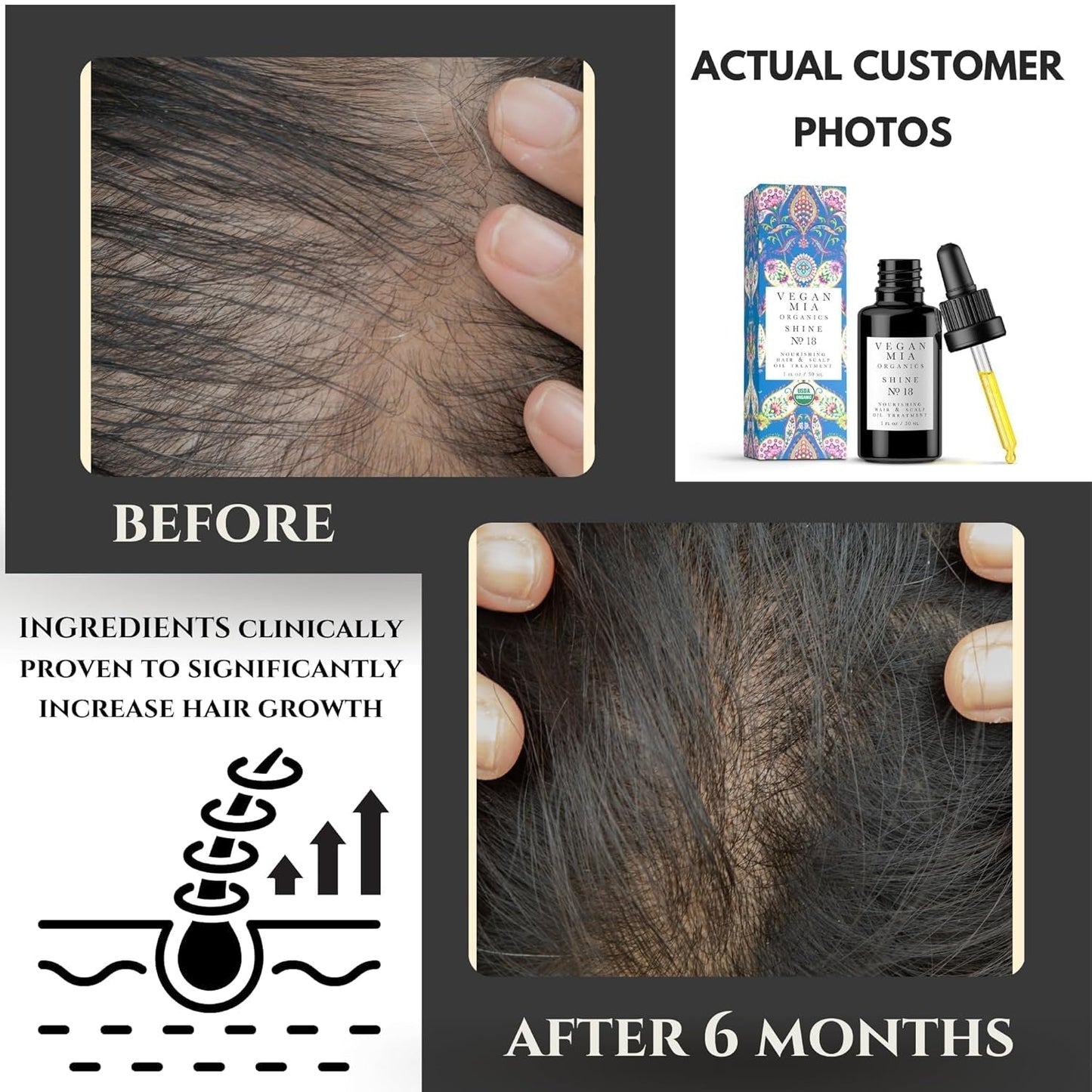USDA Organic Rosemary Oil for Hair Growth with Castor Oil & More - Scalp Oil Treatment & Intense Nourishment to Get Healthier, Thicker & Shiny Hair Naturally, 1 Fl Oz Bottle
