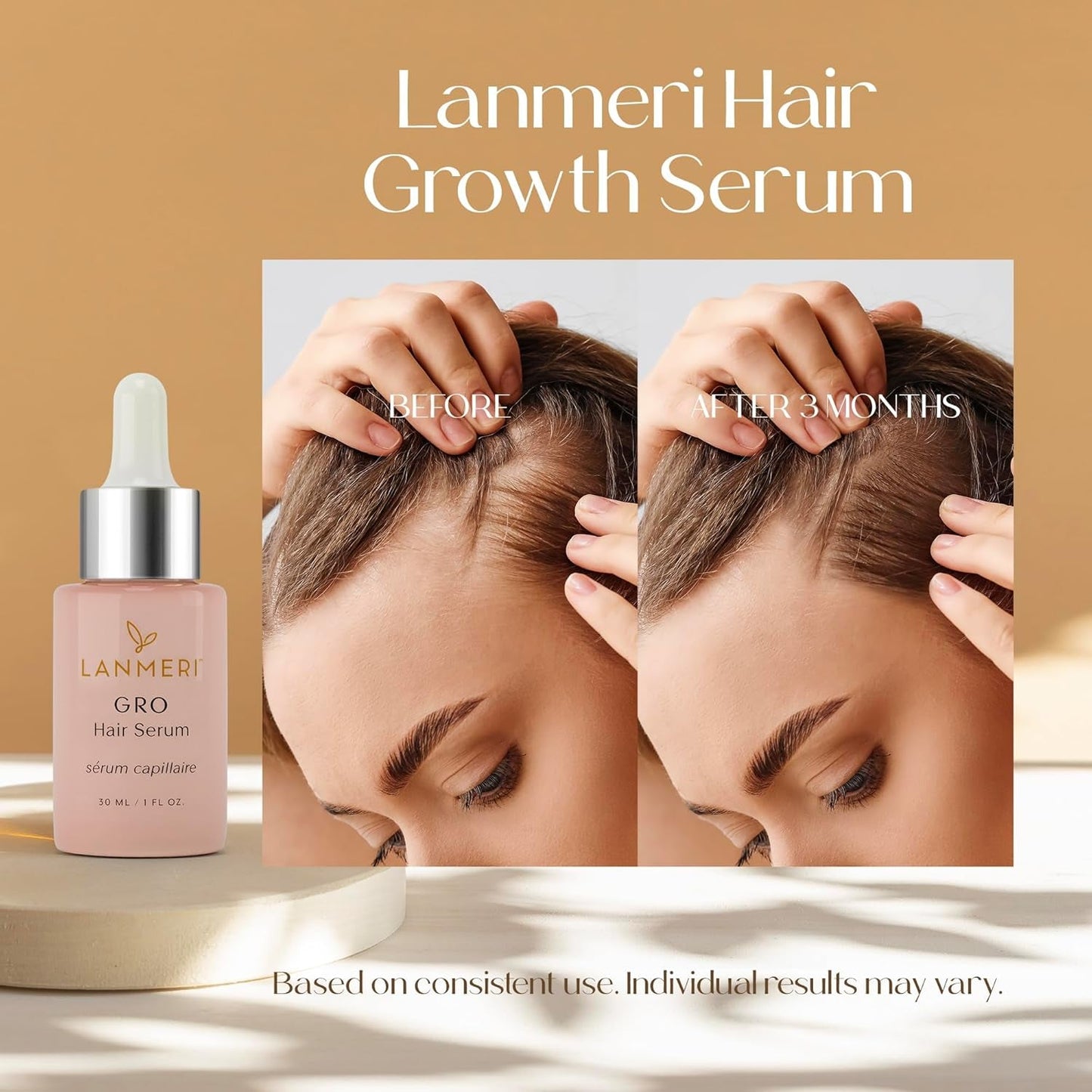 Vegan Hair Growth Serum for Women & Men - Natural Scalp Treatment for Thinning Hair and Hair Regrowth - Fuller-Looking, Thicker and Healthier Hair in 90 Days, All Hair Types - WORLD TIME VISITS