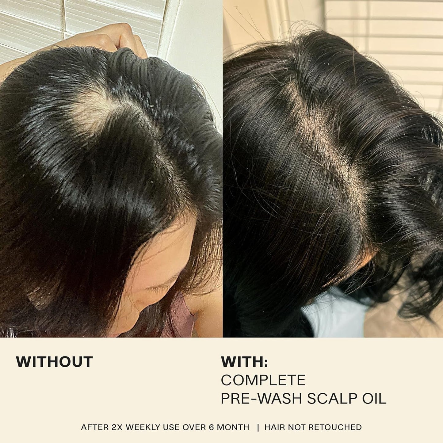 Complete Hair and Scalp Oil with Rosemary, Dry Scalp and Dry Hair Oil for All Hair Types, Silicone-Free, 1.7 Fluid Ounces