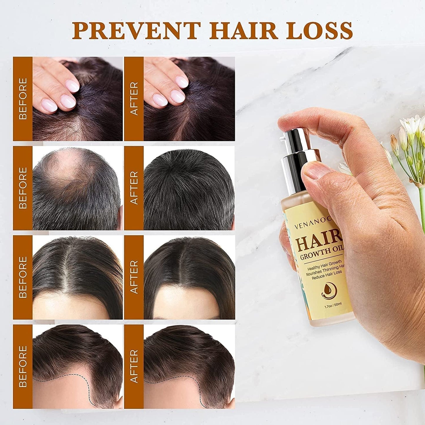 Biotin, Castor & Rosemary Oil for Hair Growth for Women, Hair Loss Treatments for Dry Damaged Hair and Growth, Serum for Thicker Longer Fuller Healthier Hair, All Natural Vitamin Rich Treatment - WORLD TIME VISITS