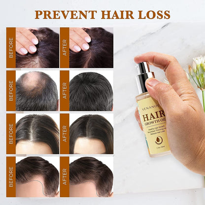 Biotin, Castor & Rosemary Oil for Hair Growth for Women, Hair Loss Treatments for Dry Damaged Hair and Growth, Serum for Thicker Longer Fuller Healthier Hair, All Natural Vitamin Rich Treatment - WORLD TIME VISITS