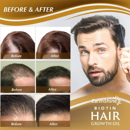 Biotin Serum: Hair Growth Oil for Thicker, Stronger Hair - Prevents Loss for Men & Women, 1.18 Oz (35 Ml)