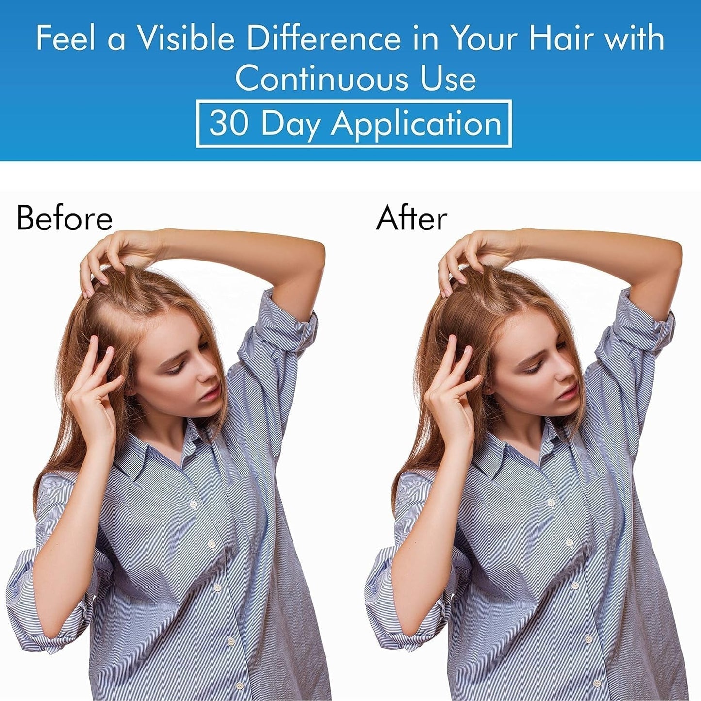 Factor Suero Natural Para El Crecimiento Del Cabello | Follicle Energizer Serum: Evita El Adelgazamiento Del Cabello Y La Pérdida De Cabello Al Estimular Los Folículos Capilares Para Producir Un Ca